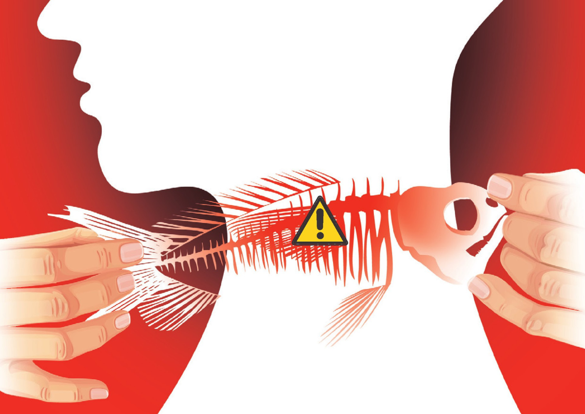 4 Mẹo Chữa Hóc Xương Cá An Toàn Và Hiệu Quả Tại Nhà
